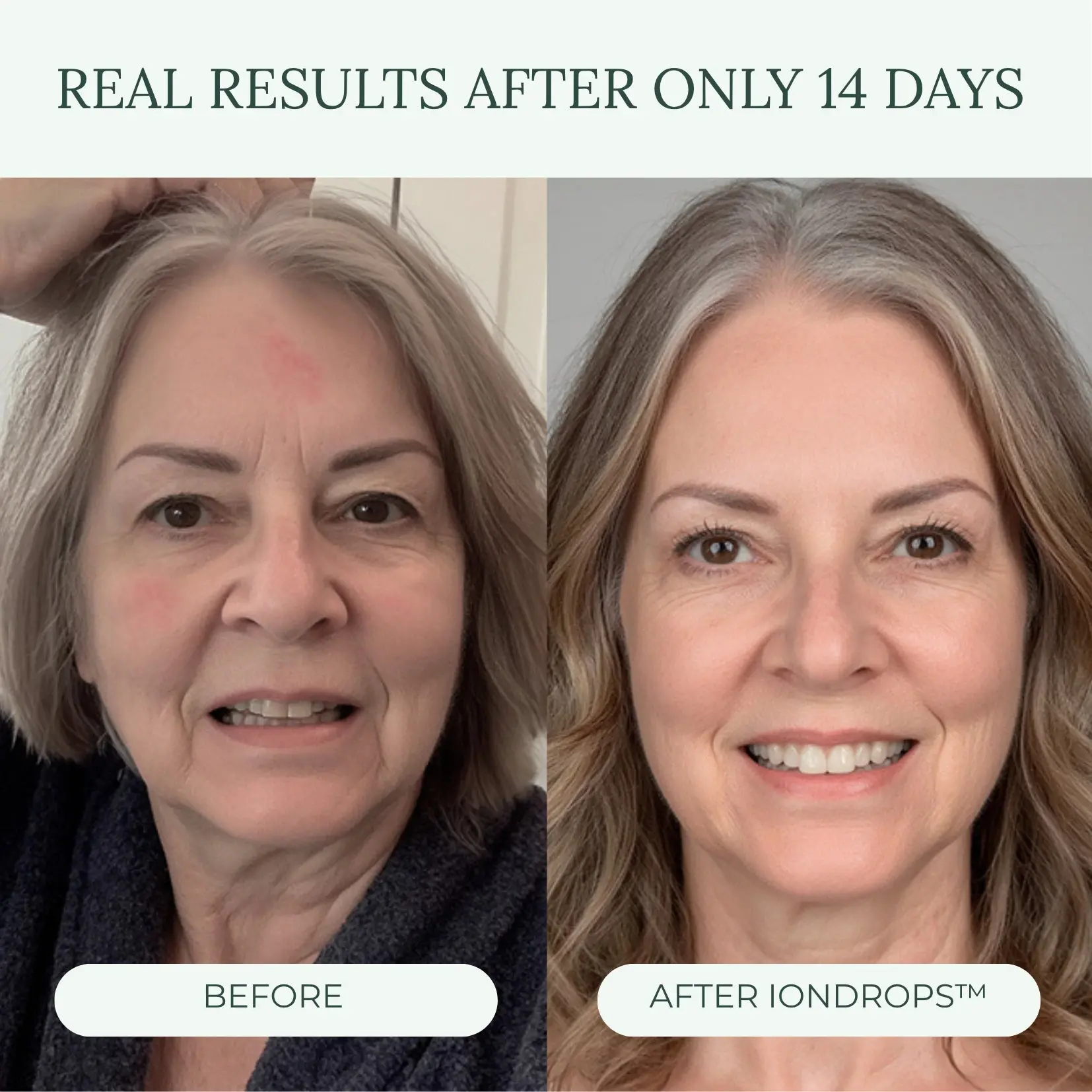 IonDrops™ - Image 4